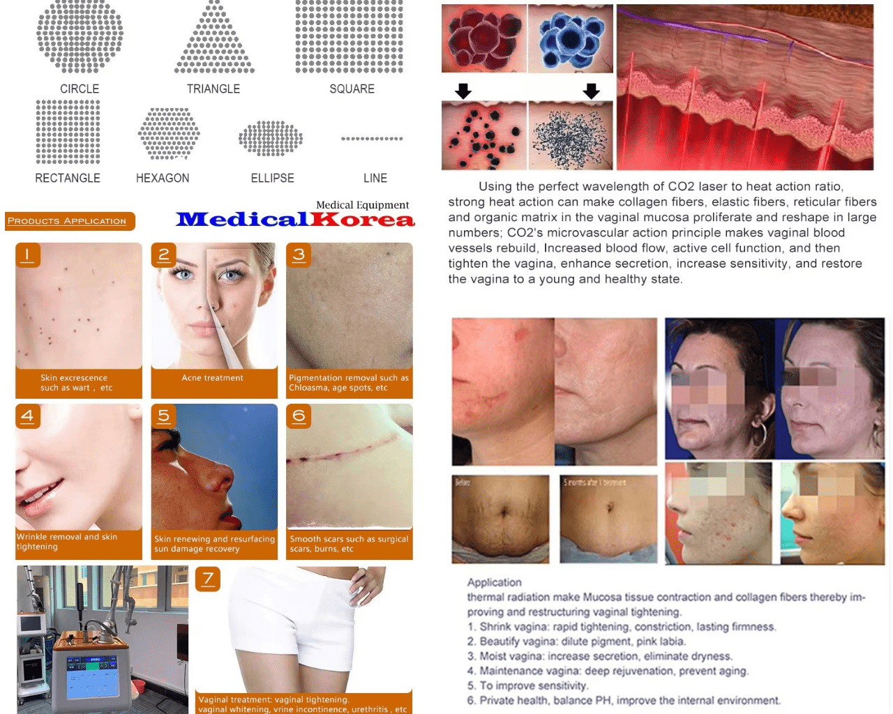 CO2 Fraktionierter Laser – Bild 8