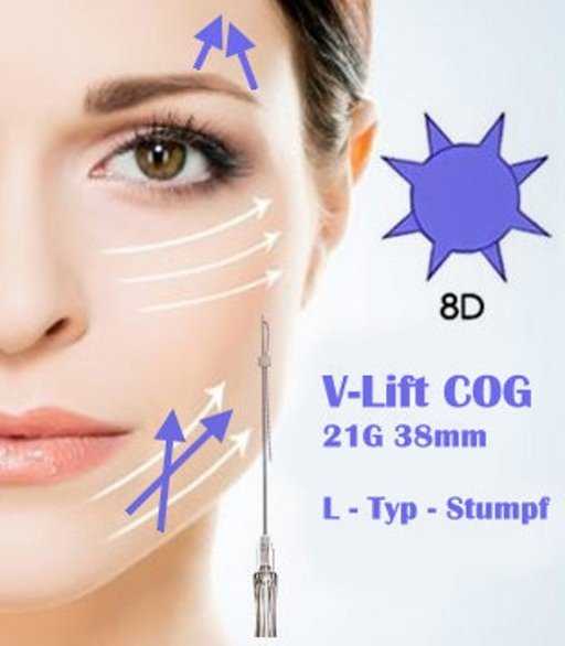 PDO Fäden COG 4-1 8D 21G 38mm V-Lift, L Typ