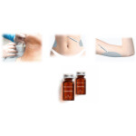 Deoxycholic Lipolytische Lösung