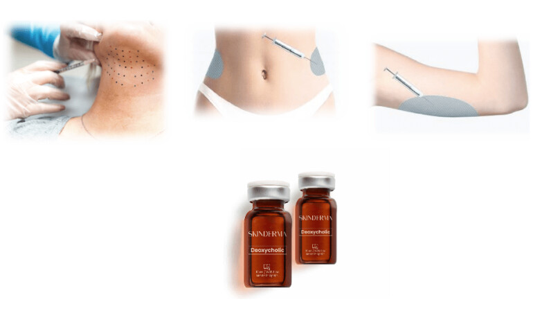 Deoxycholic Lipolytische Lösung