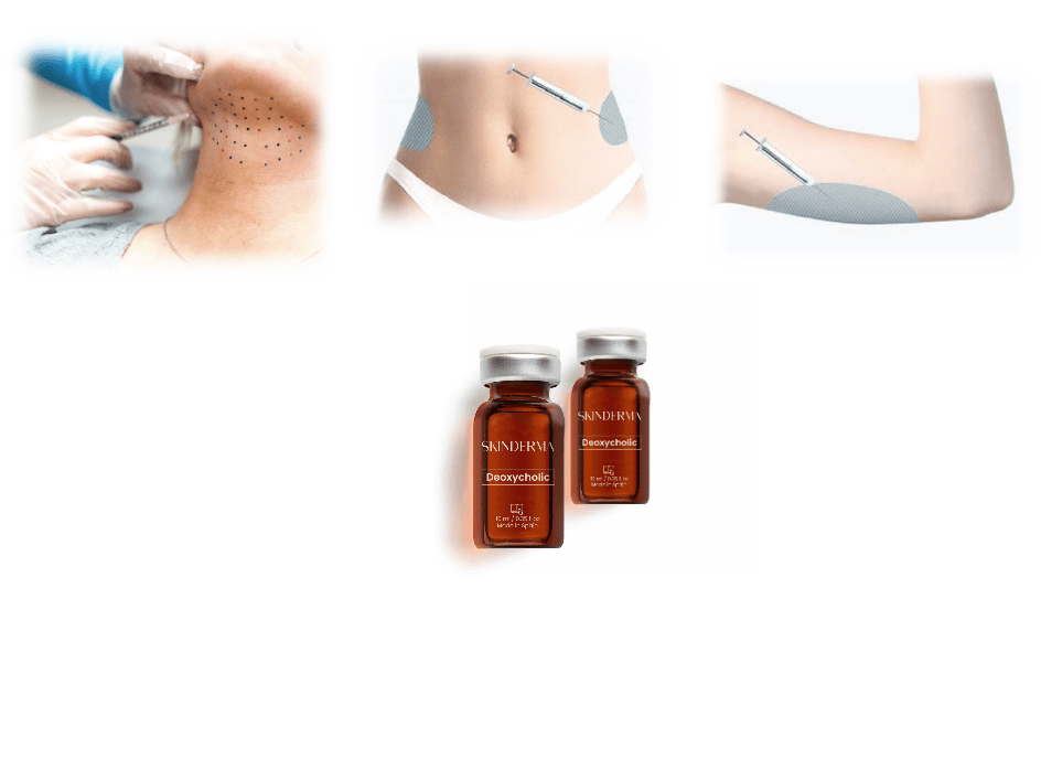 Deoxycholic Lipolytische Lösung