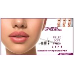 LIPS & Nasolabial Filer 2ml Hyaluron Filer Lippenaufbau