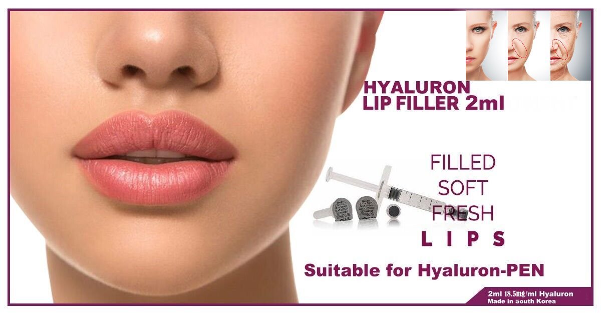 LIPS & Nasolabial Filer 2ml Hyaluron Filer Lippenaufbau